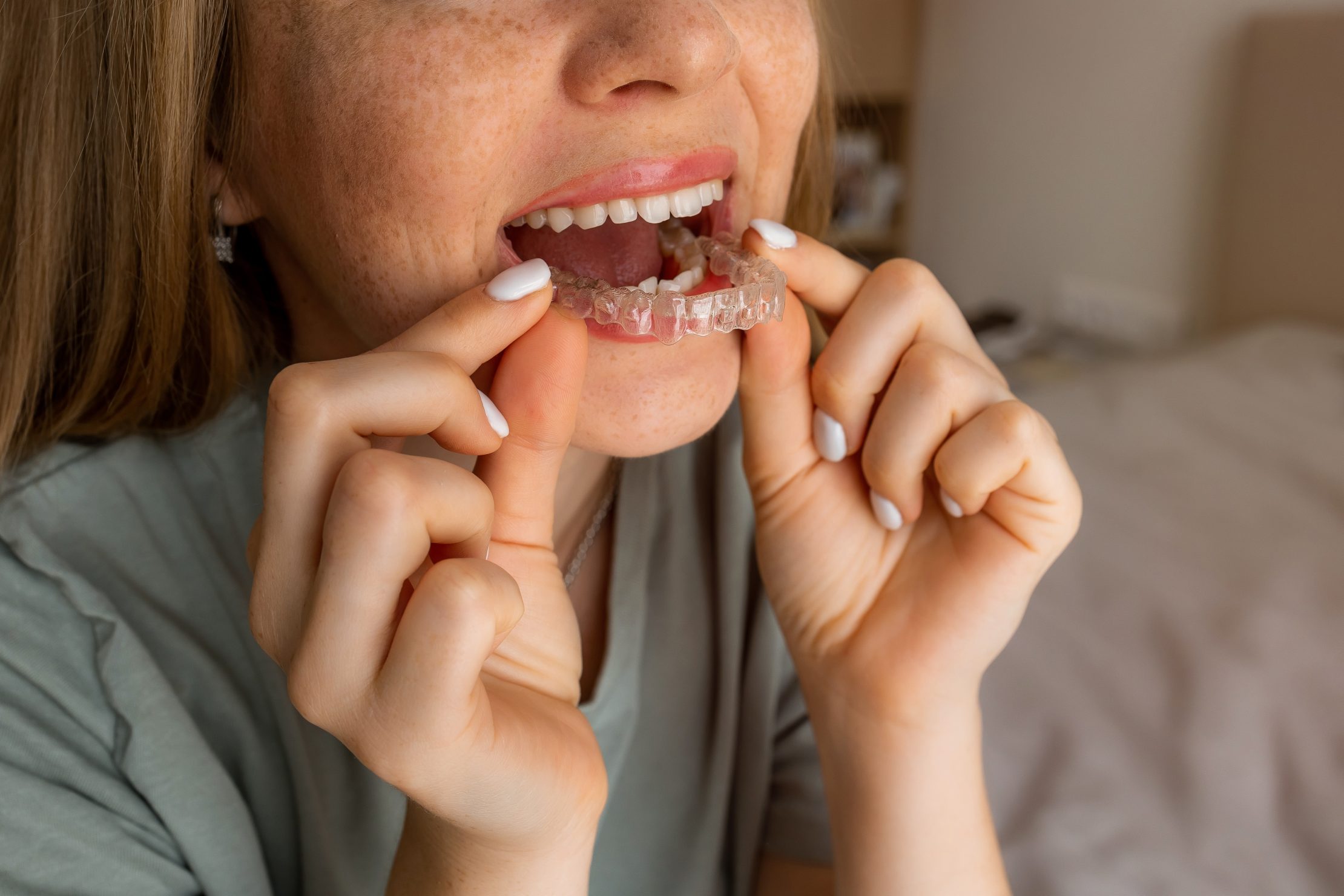 Invisalign® Clear Aligners for Teens and Adults