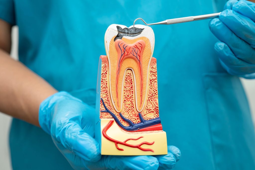 Root Canal Basics: What to Expect (and How We Keep It Comfortable)